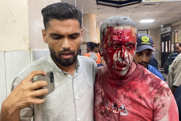 Gewonde Palestijnse fotojournalist Hatem Omar wordt geholpen na de aanval.