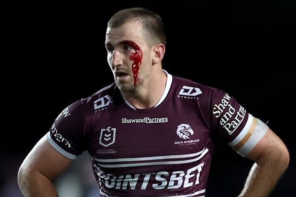 Lachlan Croker liep slechtere slijtage op na een botsing met Josh Papalii uit Canberra in 2024.